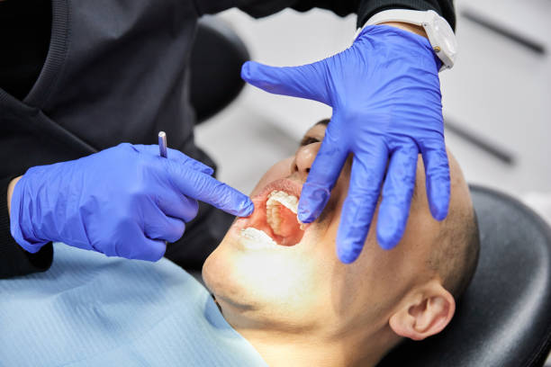 Best Emergency Dental Extractions in Lusby, MD